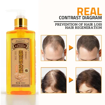300ml Hakiki Profesyonel Saç Zencefil Şampuanı Saç Çıkma Yoğun Hızlı Kalın Şampuan Anti Saç Dökülmesi Ürünü Saç Bakımı Sevich