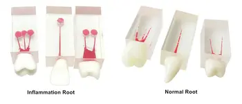 6 Adet Diş Dosya Tren RCT Kök Kanal Çalışma Uygulama Modeli Endodontik Kırmızı Hamuru